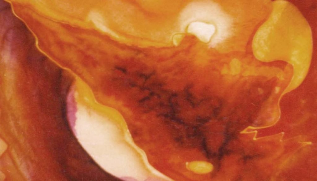 Course Catalog LESLIE STAGER RN, LMT